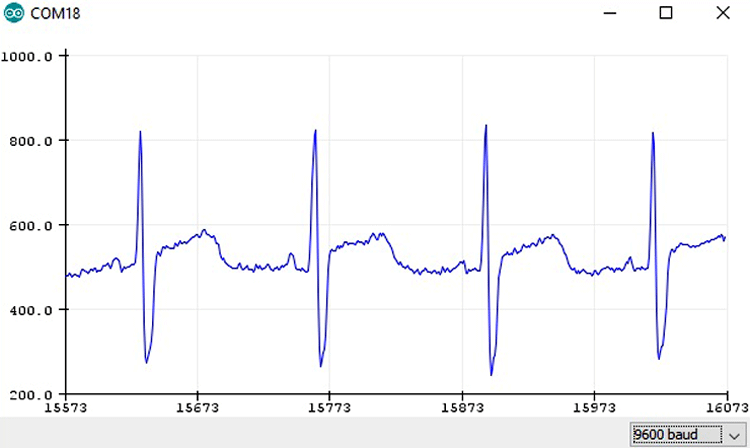 Arduino based ECG