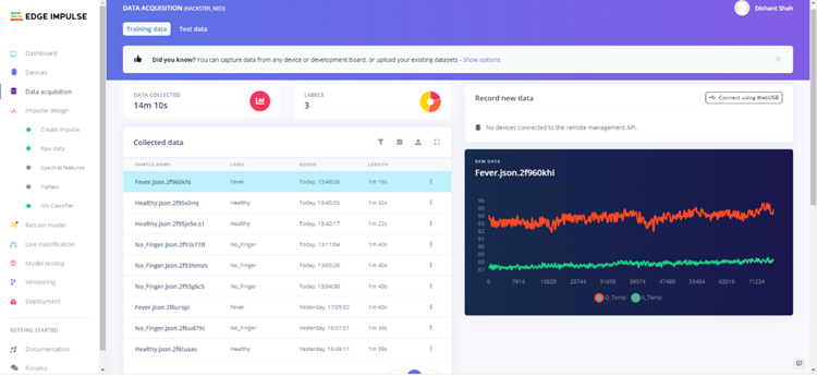 Fever Detection Model with Edge Impulse Studio